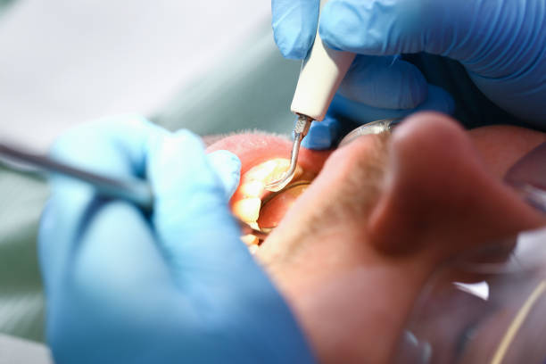 Best Broken or Chipped Tooth Repair in Acres Green, CO